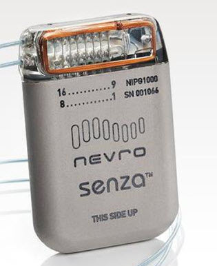 Nevro spinal stimulation Nevro spinal stimulation